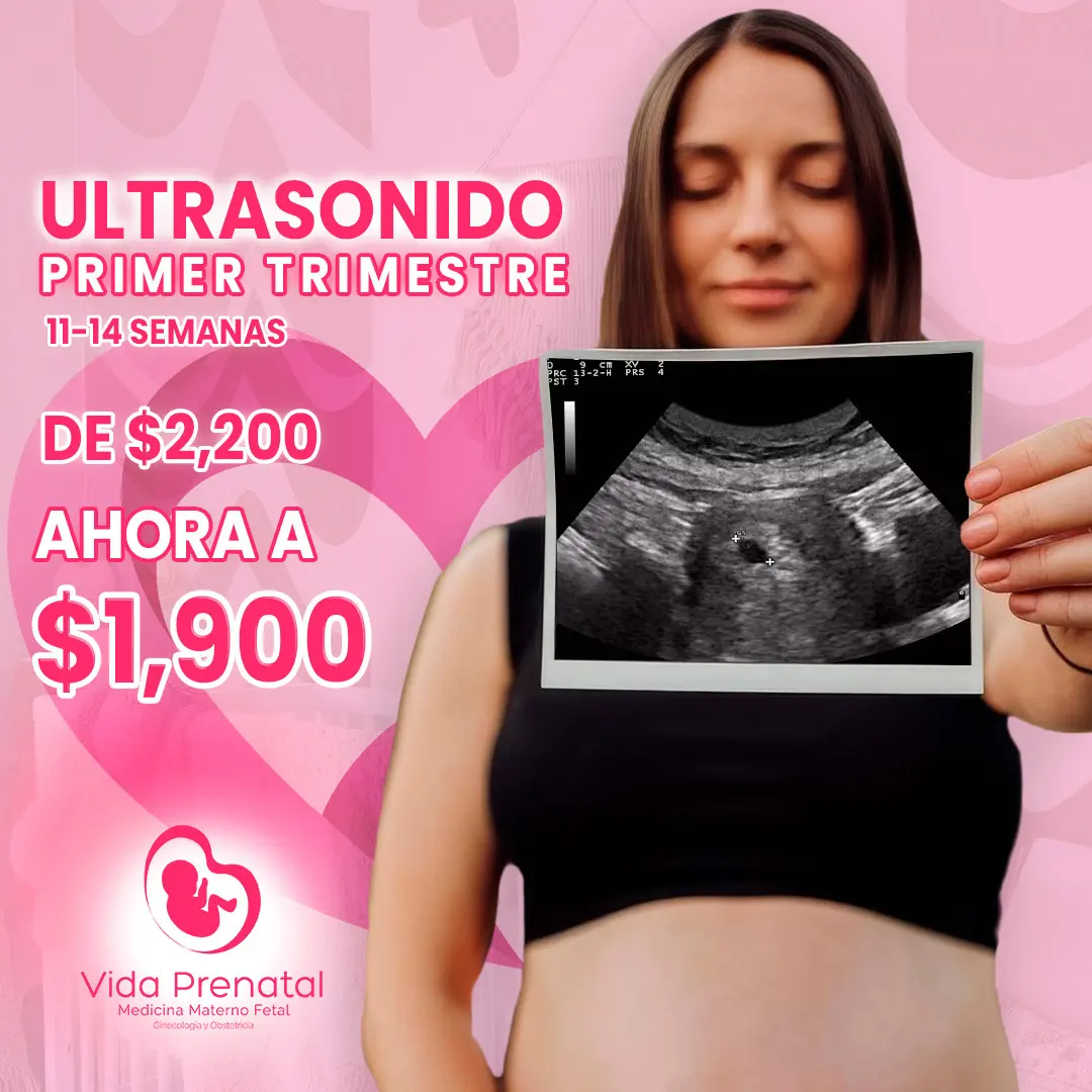 Promoción Ultrasonido primer trimestre 11 - 14 semanas