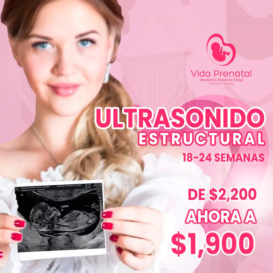 Promoción Ultrasonido Estructural 18-24 Semanas