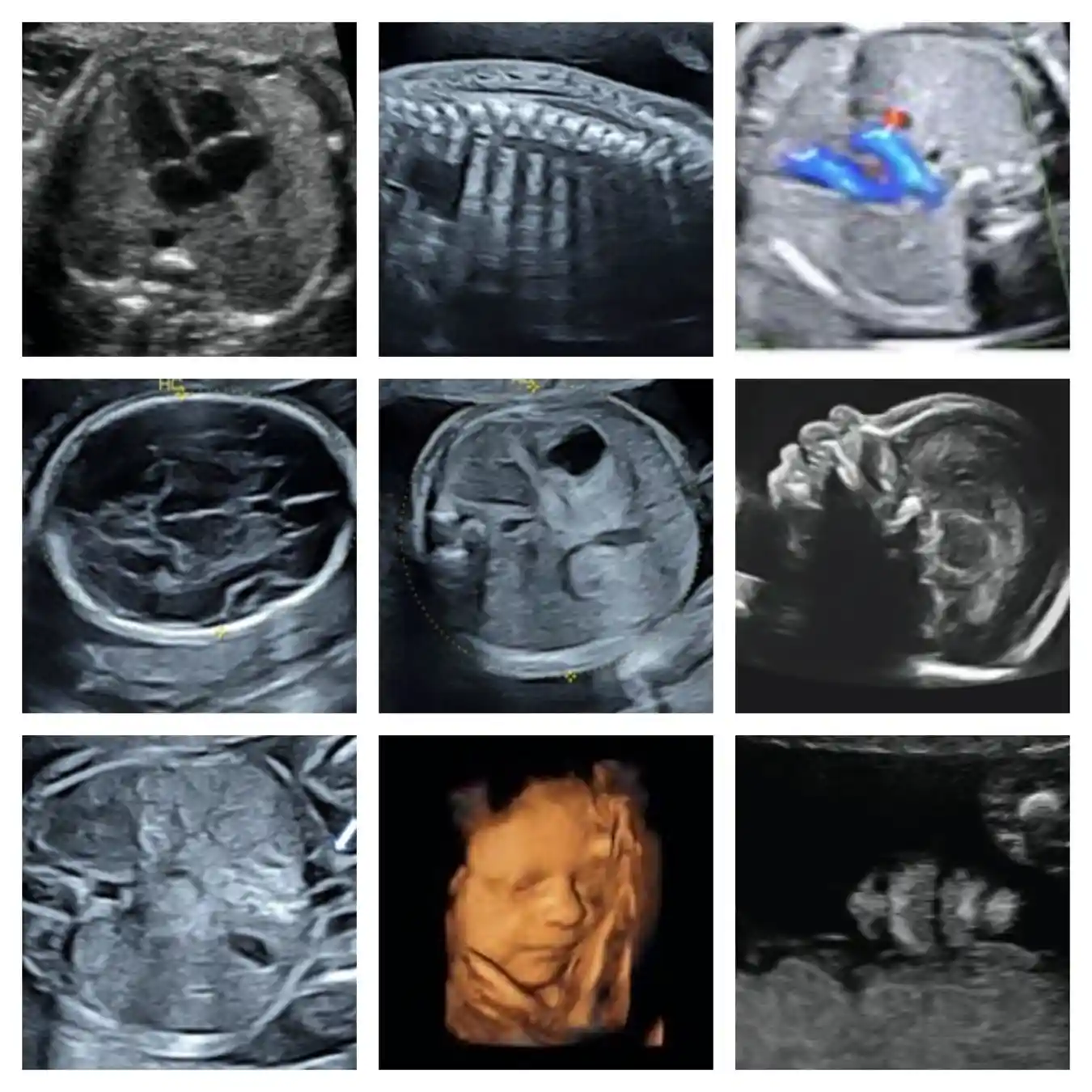 Imagen Presentación